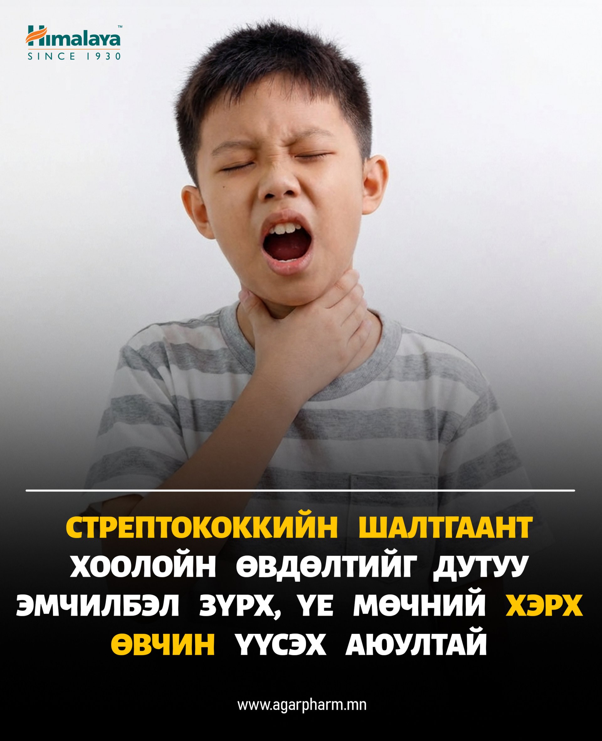 Гүйлсэн булчирхайн үрэвсэл буюу хоолойн өвдөлтийг тоохгүй өнгөрөөж болохгүй