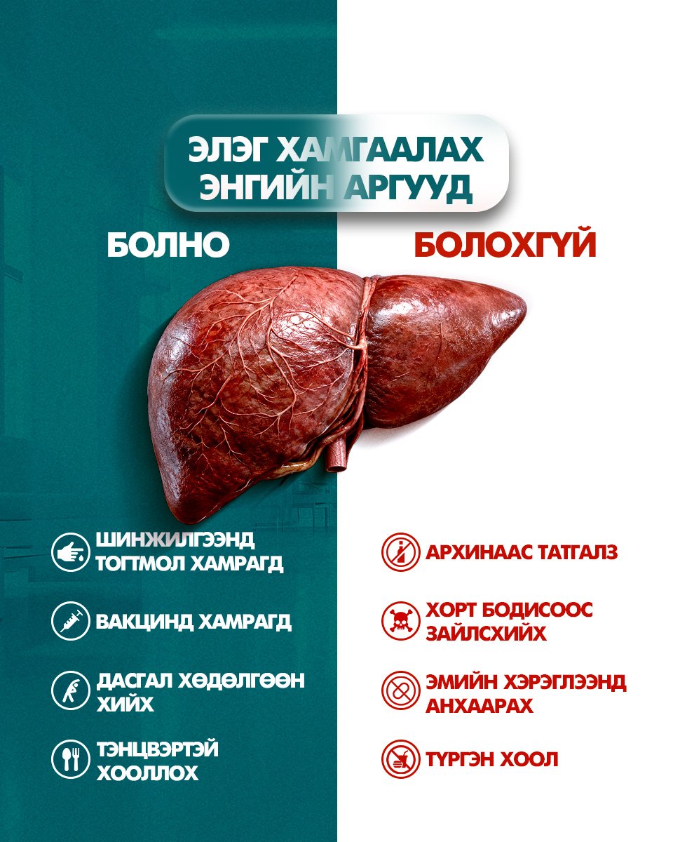 Элгээ хамгаалах энгийн аргууд